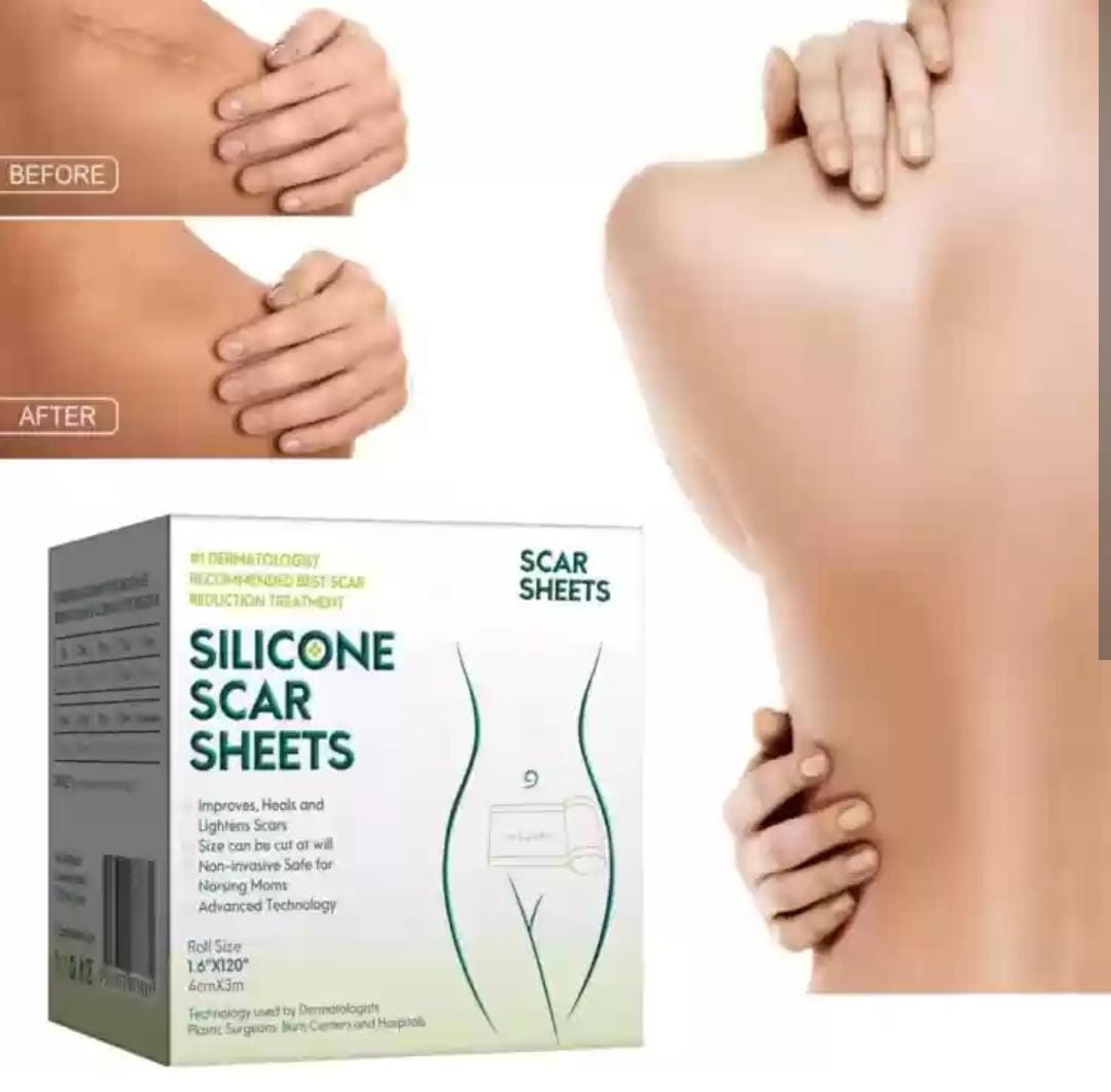 Silicone Scar Sheets TF-59